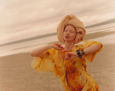 Meet the Model Fighting Misconceptions About Albinism
